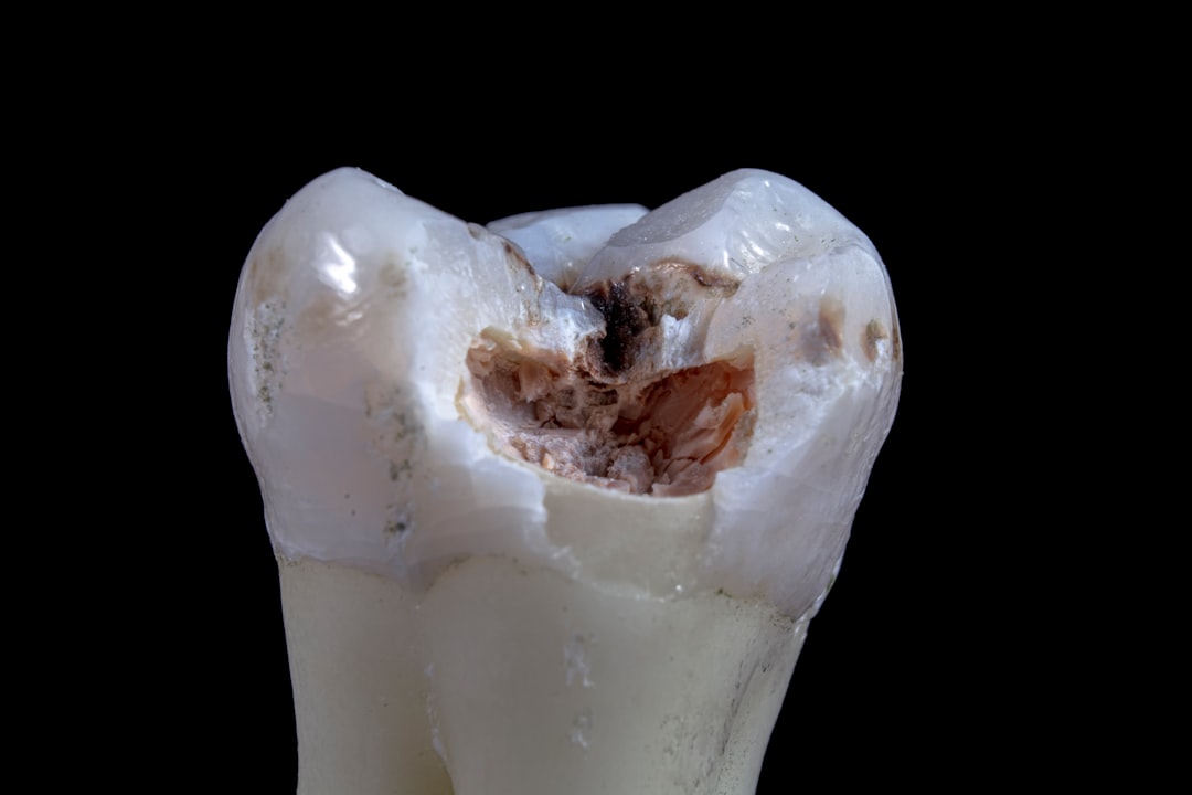 ¿Qué es la pasta de dientes con hidroxiapatita? 1 Estructura microscópica del esmalte dental