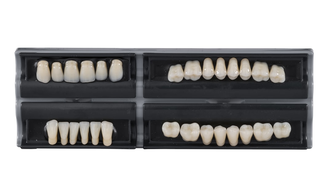 Dientes blancos: la guía definitiva para conseguir una sonrisa radiante 1 Férulas dentales personalizadas para blanqueamiento