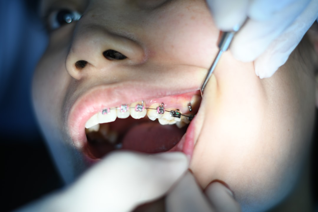 ¿Qué es la pasta de dientes con hidroxiapatita? 2 Proceso de remineralización dental con hidroxiapatita
