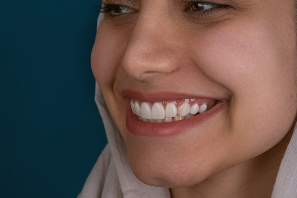 Dientes blancos: la guía definitiva para conseguir una sonrisa radiante 5 Sonrisa con dientes blancos perfectos