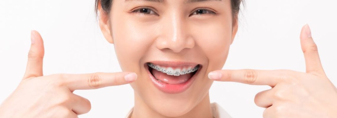 6 beneficios de la ortodoncia